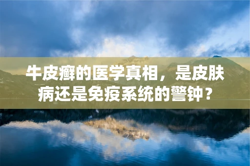 牛皮癣的医学真相，是皮肤病还是免疫系统的警钟？