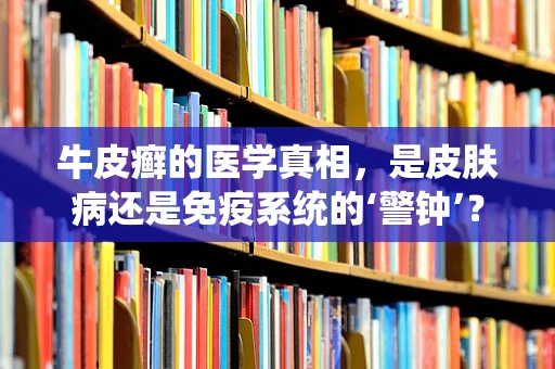 牛皮癣的医学真相，是皮肤病还是免疫系统的‘警钟’？