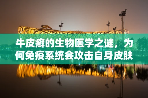 牛皮癣的生物医学之谜，为何免疫系统会攻击自身皮肤？